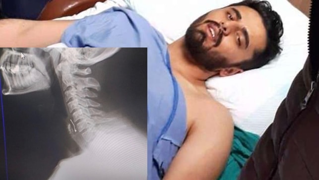 Doğum günü pastası yerken canından oluyordu