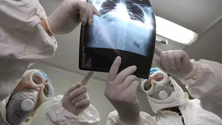 Koronavirüs için ilaç bulundu mu AIDS hastalığıyla ilgisi ne?