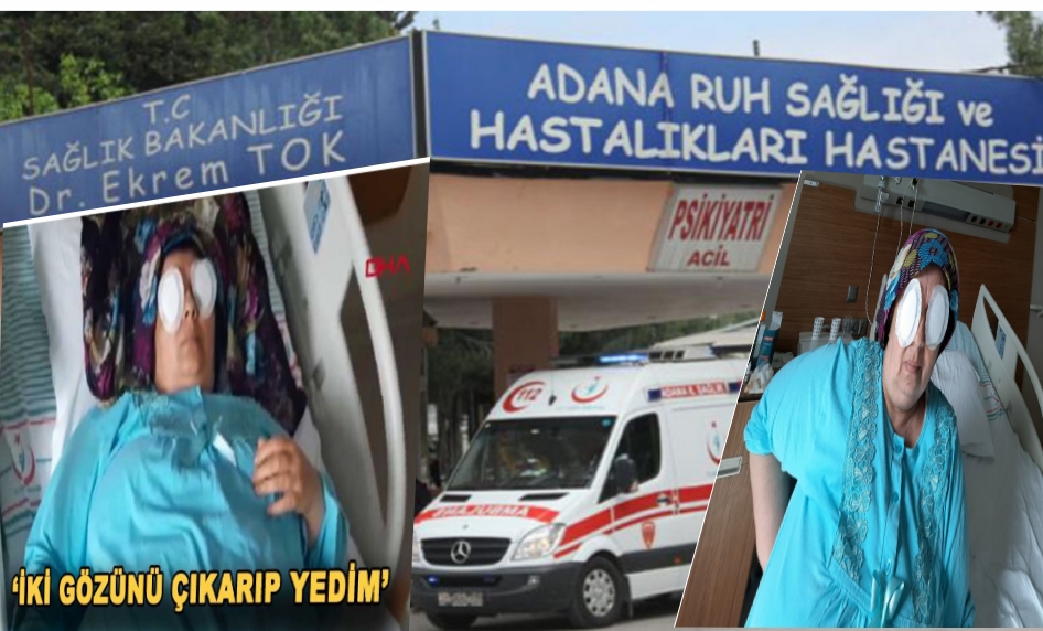 Korkunç olay Ruh sağlığı hastanesinde oda arkadaşı gözlerini oyup yedi