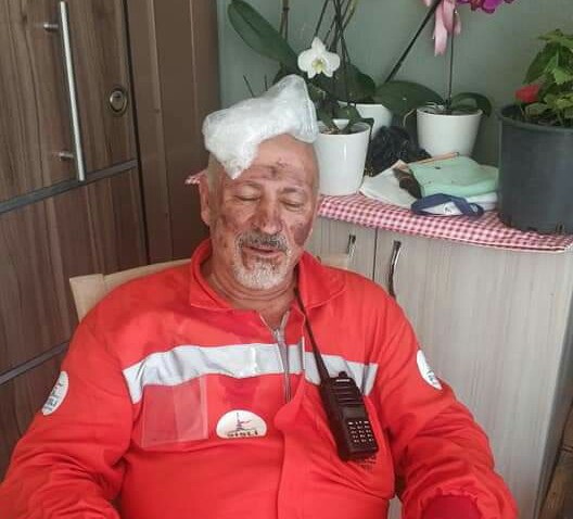 Ünlü Gazete Patronu Ali Rıza Yıldız, afet bölgesinde yangına müdahale sırasında hafif yaralandı