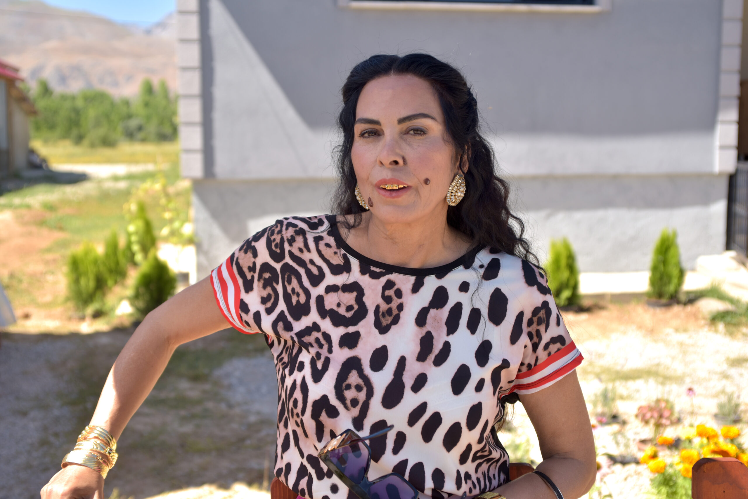 “BAŞKAN”filmi: NURSEL KÖSE ROL GEREĞİ ÇİRKİNLEŞTİ