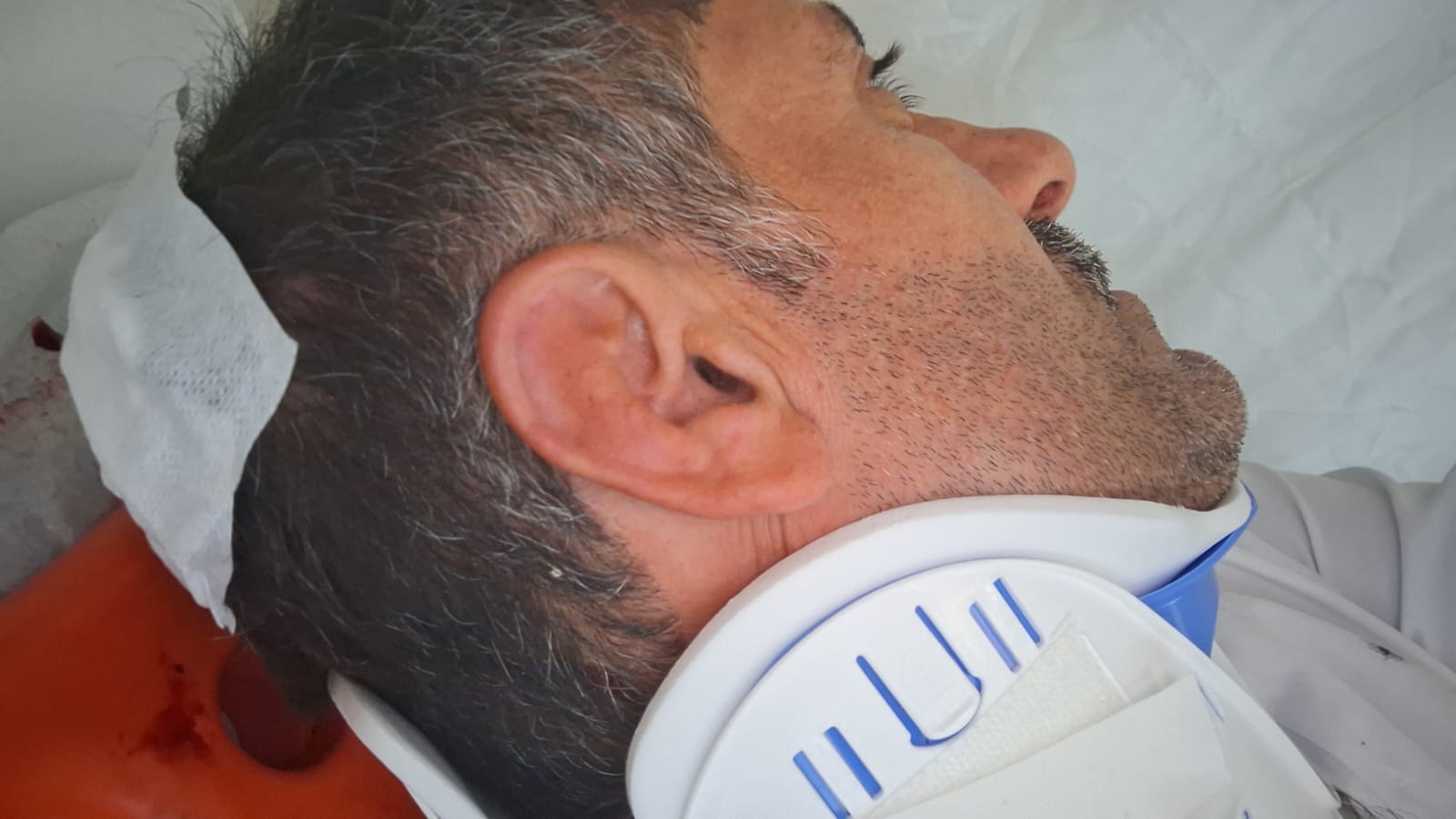 Sivas’ın Yerel Sanatçıları Büyük Bir Kazaya Karıştı: Ünal Taşlık’tan Geçmiş Olsun Mesajı