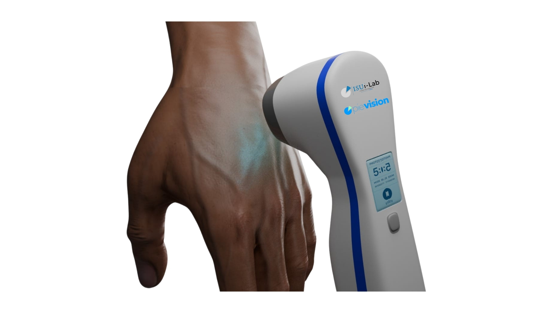 Üniversiteli Gençlerden Vitiligo Hastalarına Umut: Taşınabilir UVB LED Cihaz Geliştirildi
